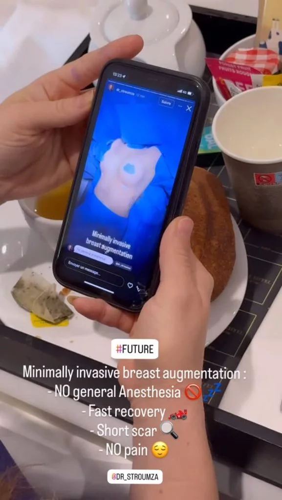 Cabinet Dr Stroumza chirurgien plasticien Paris