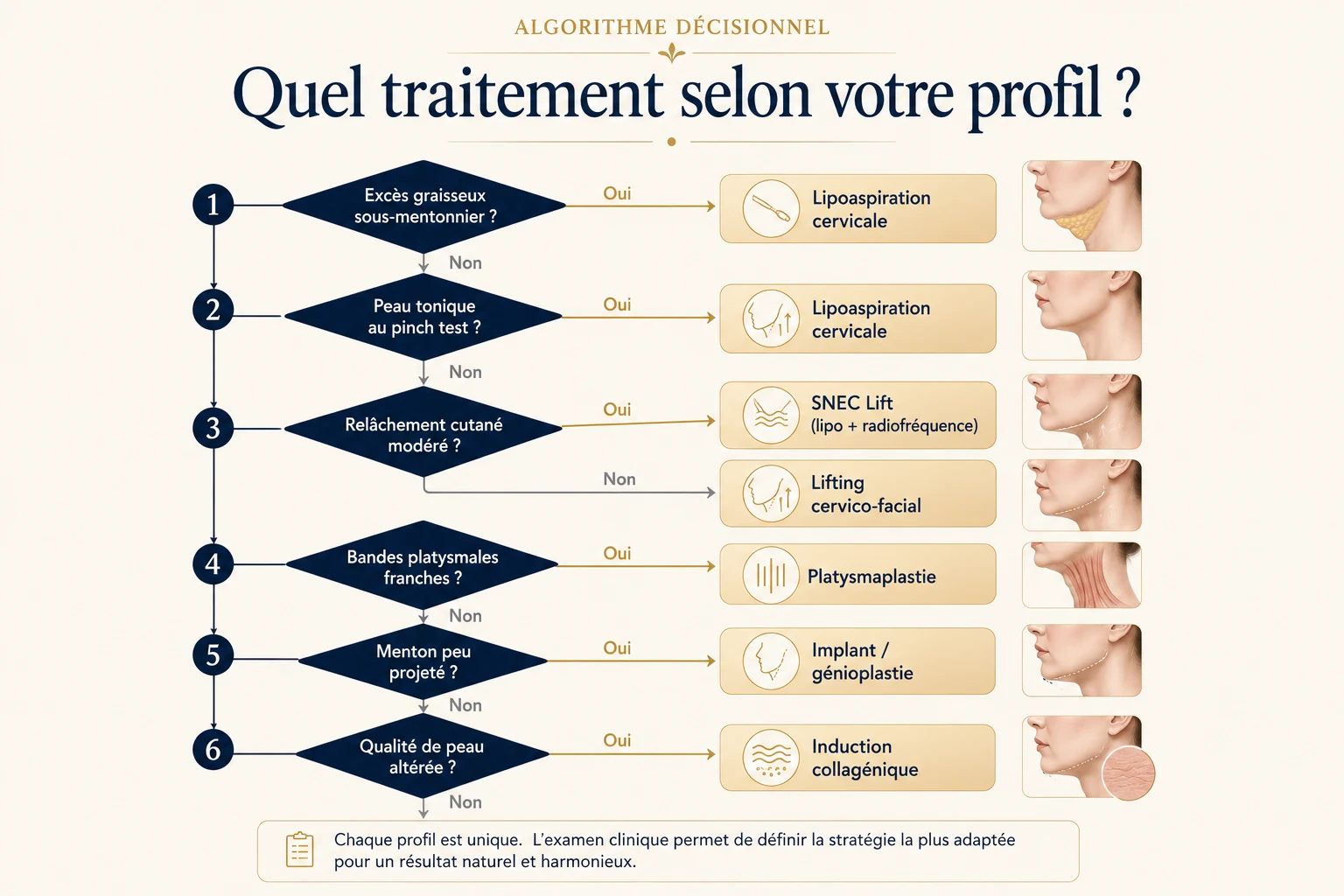 Algorithme de traitement du double menton selon le profil anatomique — Dr Stroumza-Escoffier, chirurgien plasticien Paris