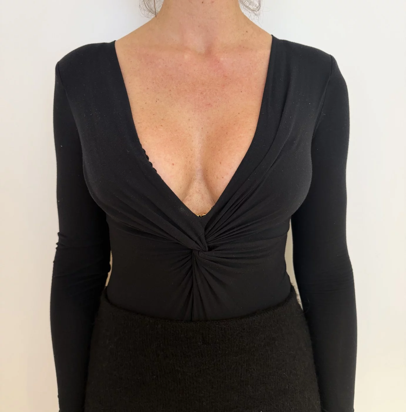 Résultat d'augmentation mammaire par voie sous-mammaire, torse nu, en lingerie et habillée — Dr Stroumza-Escoffier, Paris