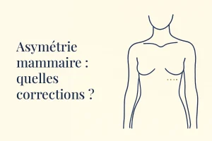 Asymétrie mammaire : différence de volume et de position entre les deux seins