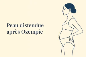 Peau distendue de l'abdomen après une perte de poids sous Ozempic
